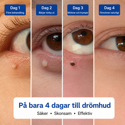 Alcura™ - Slät hud på bara 4 dagar